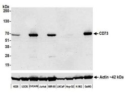 5'-Nucleotidase/CD73 Antibody (BLR054F), Novus Biologicals 100 &mu;g | Buy Online | Novus Biologicals | Fisher Scientific