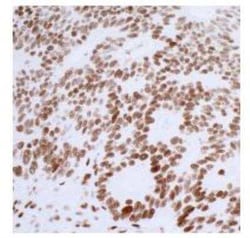 53BP1 Antibody (BL-250-1H11), Novus Biologicals 100 &mu;g; Unconjugated:Antikroppar