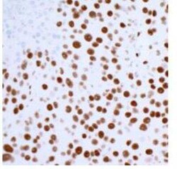 53BP1 Antibody (BL-250-1H11), Novus Biologicals 100 &mu;g; Unconjugated:Antikroppar