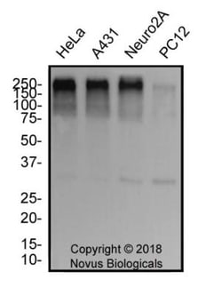 53BP1 Antibody - BSA Free, Novus Biologicals:Antibodies:Primary Antibodies