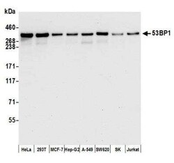 53BP1 Antibody (BL-250-1H11), Novus Biologicals 100 &mu;g; Unconjugated:Antikroppar