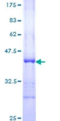 Novus Biologicals Recombinant Human 53BP1 GST (N-Term) Protein 10 &mu;g | Buy Online | Novus Biologicals&trade; | Fisher Scientific