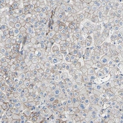 5T4 Antibody, Novus Biologicals 0.1mL; Unlabeled:Antibodies, Polyclonal