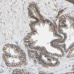 5T4 Antibody, Novus Biologicals 0.1mL; Unlabeled:Antibodies, Polyclonal