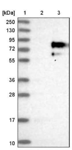 5T4 Antibody, Novus Biologicals 0.1mL; Unlabeled:Antibodies, Polyclonal