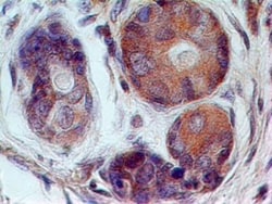5'-Nucleotidase/CD73 Antibody (45M4F9) - BSA Free, Novus Biologicals:Antibodies:Primary