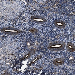 5'-Nucleotidase/CD73 Antibody, Novus Biologicals:Antibodies:Primary Antibodies