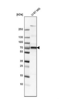 5'-Nucleotidase/CD73 Antibody, Novus Biologicals:Antibodies:Primary Antibodies