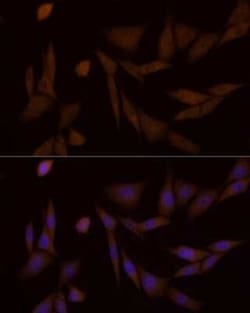 6 Phosphofructo 2 Kinase Rabbit anti-Human, Mouse, Rat, Clone: 7X2H3, Novus