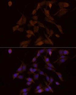 6 Phosphofructo 2 Kinase Rabbit anti-Human, Mouse, Rat, Clone: 7X2H3, Novus