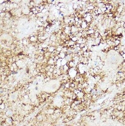 6 Phosphofructo 2 Kinase Rabbit anti-Human, Mouse, Rat, Clone: 7X2H3, Novus