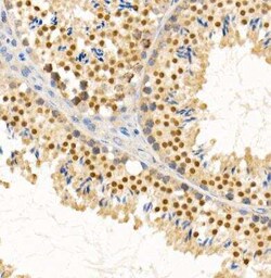 6 Phosphofructo 2 Kinase Rabbit anti-Human, Mouse, Rat, Clone: 7X2H3, Novus