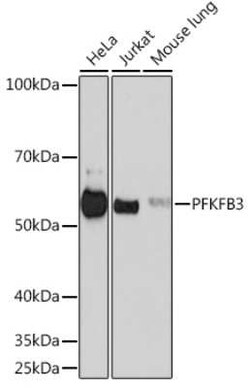 6 Phosphofructo 2 Kinase Rabbit anti-Human, Mouse, Rat, Clone: 7X2H3, Novus