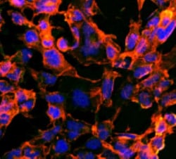 7-Ketocholesterol Antibody (3F7), Novus Biologicals:Antibodies:Primary
