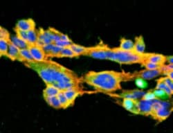 7-Ketocholesterol Antibody (7E1), Novus Biologicals 25 &mu;g; Unlabeled:Antibodies,