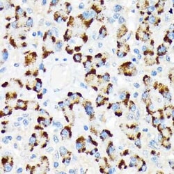 A-RAF Rabbit anti-Human, Clone: 4U9L7, Novus Biologicals 100 &mu;g; Unconjugated:Antibodies,