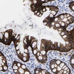 A33/GPA33 Antibody, Novus Biologicals 0.1mL; Unlabeled:Antibodies, Polyclonal