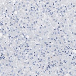 A33/GPA33 Antibody, Novus Biologicals 0.1mL; Unlabeled:Antibodies, Polyclonal