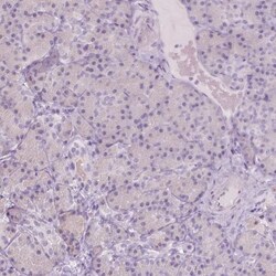 A4GNT Antibody, Novus Biologicals:Antibodies:Primary Antibodies