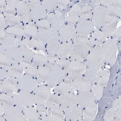 AASS Antibody, Novus Biologicals 0.1mL; Unlabeled:Antibodies, Polyclonal