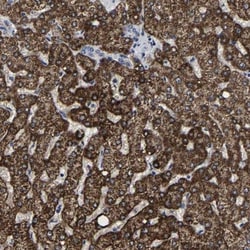 AASS Antibody, Novus Biologicals 0.1mL; Unlabeled:Antibodies, Polyclonal