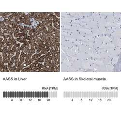 AASS Antibody, Novus Biologicals 0.1mL; Unlabeled:Antibodies, Polyclonal
