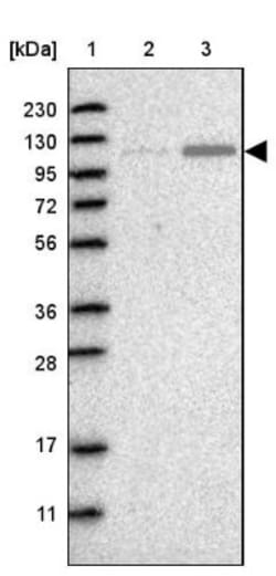 AASS Antibody, Novus Biologicals 0.1mL; Unlabeled:Antibodies, Polyclonal