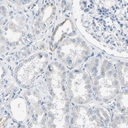 AATK/Serine/threonine-protein kinase LMTK1 Antibody, Novus Biologicals:Antibodies:Primary