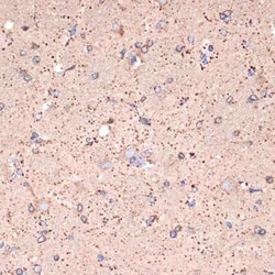 ABAT Rabbit anti-Human, Mouse, Rat, Clone: 10V1K9, Novus Biologicals 20