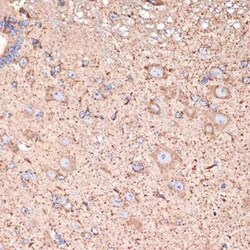 ABAT Rabbit anti-Human, Mouse, Rat, Clone: 10V1K9, Novus Biologicals 20