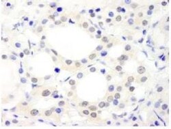 ABC2 Antibody, Novus Biologicals 0.1mg; Unlabeled:Antibodies, Polyclonal