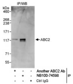 ABC2 Antibody, Novus Biologicals 0.1mg; Unlabeled:Antibodies, Polyclonal