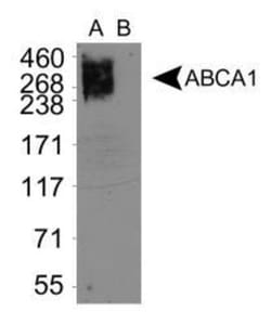 ABCA1 Antibody (3A1.891.3), Novus Biologicals 0.1mL; Unlabeled:Antibodies,