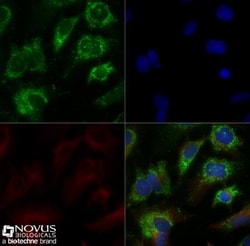 ABCA1 Antibody - BSA Free, Novus Biologicals 0.1mL; Unlabeled:Antibodies,