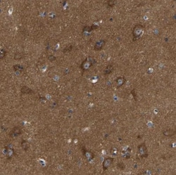 ABCA10 Antibody, Novus Biologicals:Antibodies:Primary Antibodies