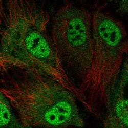 ABCA3 Antibody, Novus Biologicals 0.1mL; Unlabeled:Antibodies, Polyclonal
