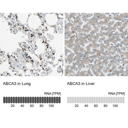 ABCA3 Antibody, Novus Biologicals 0.1mL; Unlabeled:Antibodies, Polyclonal