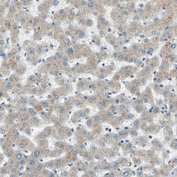 ABCA3 Antibody, Novus Biologicals 0.1mL; Unlabeled:Antibodies, Polyclonal