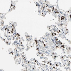 ABCA3 Antibody, Novus Biologicals 0.1mL; Unlabeled:Antibodies, Polyclonal