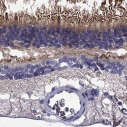 ABCA4 Rabbit anti-Human, Polyclonal, Novus Biologicals 100 &mu;g; Unconjugated:Antibodies,