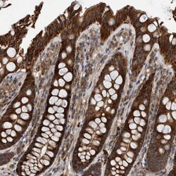 ABCA5 Antibody, Novus Biologicals 0.1mL; Unlabeled:Antibodies, Polyclonal