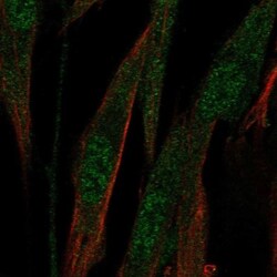 ABCA8 Antibody, Novus Biologicals 25 &mu;L; Unlabeled:Antibodies, Polyclonal