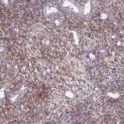 ABCA8 Antibody, Novus Biologicals 25 &mu;L; Unlabeled:Antibodies, Polyclonal