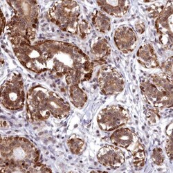 ABCB8 Antibody, Novus Biologicals 0.1mL; Unlabeled:Antibodies, Polyclonal