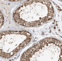 ABCB9 Antibody, Novus Biologicals 25ul | Buy Online | Novus Biologicals | Fisher Scientific