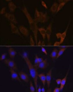 ABCE1 Rabbit anti-Human, Mouse, Clone: 1N4I7, Novus Biologicals 100 &mu;g | Buy Online | Novus Biologicals | Fisher Scientific