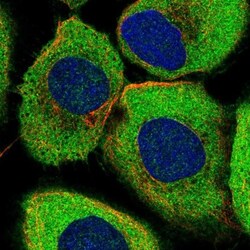 ABCF2 Antibody, Novus Biologicals 0.1mL; Unlabeled:Antibodies, Polyclonal