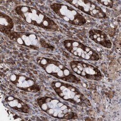 ABCF2 Antibody, Novus Biologicals 0.1mL; Unlabeled:Antibodies, Polyclonal