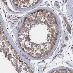 ABCF2 Antibody, Novus Biologicals 0.1mL; Unlabeled:Antibodies, Polyclonal