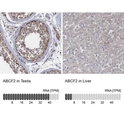 ABCF2 Antibody, Novus Biologicals 0.1mL; Unlabeled:Antibodies, Polyclonal